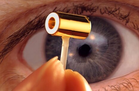 100128-coslog-hohlraum-466px-10a.jpg 100128-coslog-hohlraum-466px-10a.jpg