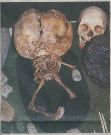 brazil-star-child-skull-skeleton.jpg