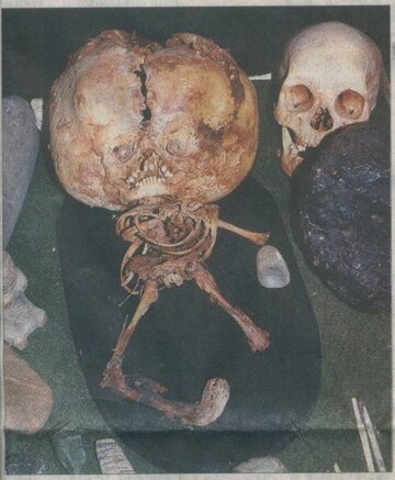 brazil-star-child-skull-skeleton.jpg brazil-star-child-skull-skeleton.jpg