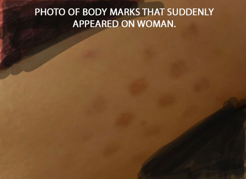body-marks-edited.jpg body-marks-edited.jpg